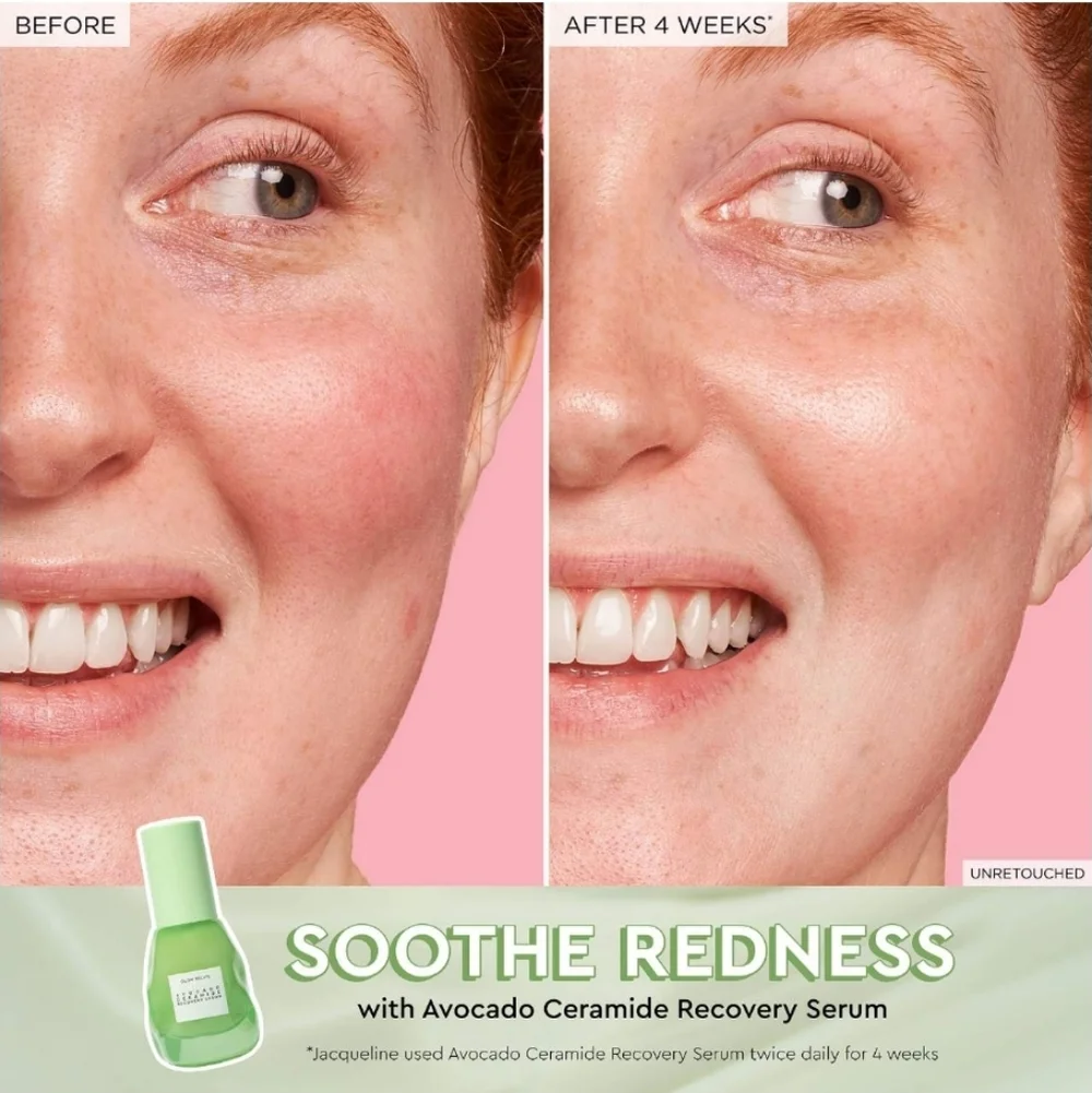 Glow Recipe Avocado Ceramide Recovery Serum, 30ml, NIB - Picture 3 of 7